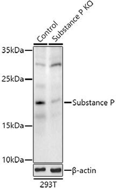 Western blot analysis of extracts from normal (control) and Substance P knockout (KO) 293T cells, using Substance P antibody at 1:500 dilution. Secondary antibody: HRP Goat Anti-Rabbit IgG (H+L) at 1:10000 dilution. Lysates/proteins: 25ug per lane. Blocking buffer: 3% nonfat dry milk in TBST. Detection: ECL Enhanced Kit. Exposure time: 300s.