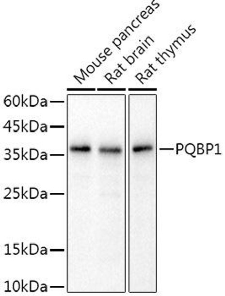 Western blot analysis of extracts of various cell lines, using PQBP1 antibody at 1:1000 dilution. Secondary antibody: HRP Goat Anti-Rabbit IgG (H+L) at 1:10000 dilution. Lysates/proteins: 25ug per lane. Blocking buffer: 3% nonfat dry milk in TBST. Detection: ECL Basic Kit. Exposure time: 3s.