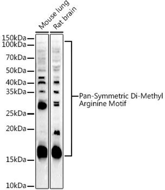 Western blot analysis of extracts of various cell lines, using Pan-Symmetric Di-Methyl Arginine Motif antibody at 1:1000 dilution. Secondary antibody: HRP Goat Anti-Rabbit IgG (H+L) at 1:10000 dilution. Lysates/proteins: 25ug per lane. Blocking buffer: 3% nonfat dry milk in TBST. Detection: ECL Enhanced Kit. Exposure time: 90s.
