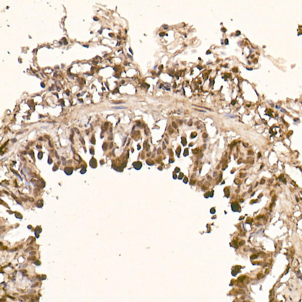 Immunohistochemistry of paraffin-embedded rat lung using [KO Validated] AKT1 Rabbit mAb at dilution of 1:100 (40x lens). Perform high pressure antigen retrieval with 10 mM citrate buffer pH 6. 0 before commencing with IHC staining protocol.