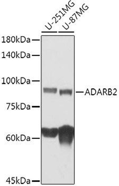 Western blot analysis of extracts of various cell lines, using ADARB2 antibody at 1:1000 dilution. Secondary antibody: HRP Goat Anti-Rabbit IgG (H+L) at 1:10000 dilution. Lysates/proteins: 25ug per lane. Blocking buffer: 3% nonfat dry milk in TBST. Detection: ECL Basic Kit. Exposure time: 60s.