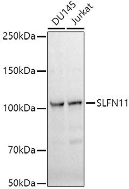 Western blot analysis of extracts of various cell lines, using SLFN11 antibody at 1:1000 dilution. Secondary antibody: HRP Goat Anti-Rabbit IgG (H+L) at 1:10000 dilution. Lysates/proteins: 25ug per lane. Blocking buffer: 3% nonfat dry milk in TBST. Detection: ECL Basic Kit. Exposure time: 10s.