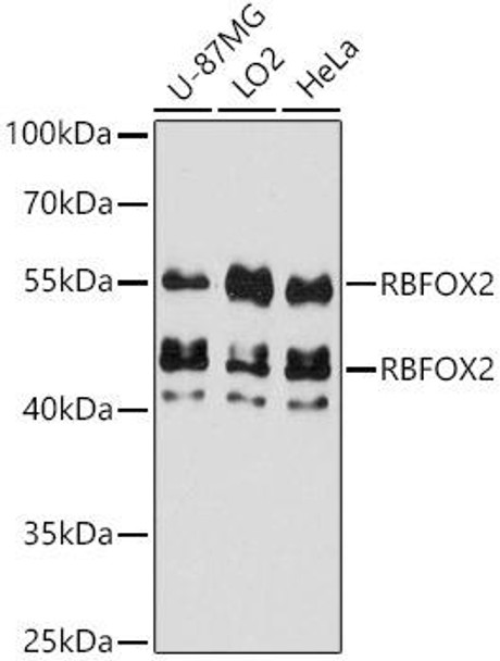 Western blot analysis of extracts of various cell lines, using RBFOX2 antibody at 1:3000 dilution. Secondary antibody: HRP Goat Anti-Rabbit IgG (H+L) at 1:10000 dilution. Lysates/proteins: 25ug per lane. Blocking buffer: 3% nonfat dry milk in TBST. Detection: ECL Basic Kit. Exposure time: 60s.