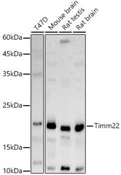 Western blot analysis of extracts of various cell lines, using Timm22 antibody at 1:1000 dilution. Secondary antibody: HRP Goat Anti-Rabbit IgG (H+L) at 1:10000 dilution. Lysates/proteins: 25ug per lane. Blocking buffer: 3% nonfat dry milk in TBST. Detection: ECL Basic Kit. Exposure time: 180s.