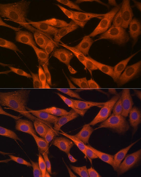 Immunofluorescence analysis of NIH/3T3 cells using HSP70 Rabbit pAb at dilution of 1:100 (40x lens). Blue: DAPI for nuclear staining.