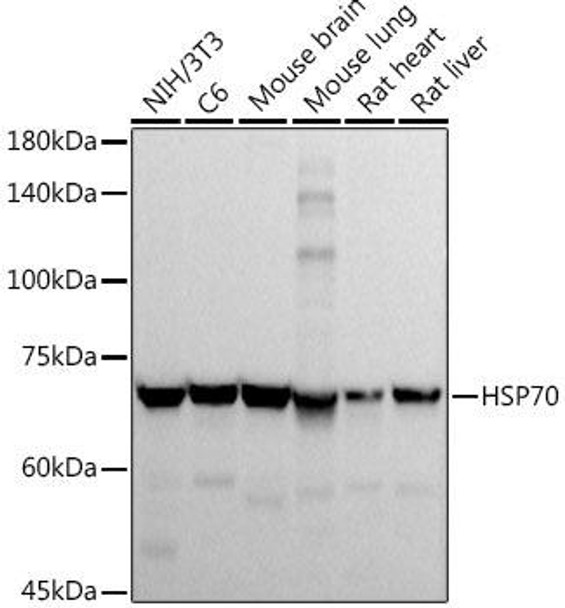 Western blot analysis of extracts of various cell lines, using HSP70 antibody at 1:1000 dilution. Secondary antibody: HRP Goat Anti-Rabbit IgG (H+L) at 1:10000 dilution. Lysates/proteins: 25ug per lane. Blocking buffer: 3% nonfat dry milk in TBST. Detection: ECL Basic Kit. Exposure time: 10s.