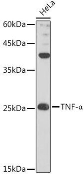 Western blot analysis of extracts of HeLa cells, using TNF-α antibody at 1:1000 dilution. Secondary antibody: HRP Goat Anti-Rabbit IgG (H+L) at 1:10000 dilution. Lysates/proteins: 25ug per lane. Blocking buffer: 3% nonfat dry milk in TBST. Detection: ECL Basic Kit. Exposure time: 90s.