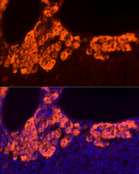 Immunofluorescence analysis of Human adrenal gland cells using PNMT Rabbit mAb at dilution of 1:100 (40x lens). Blue: DAPI for nuclear staining.