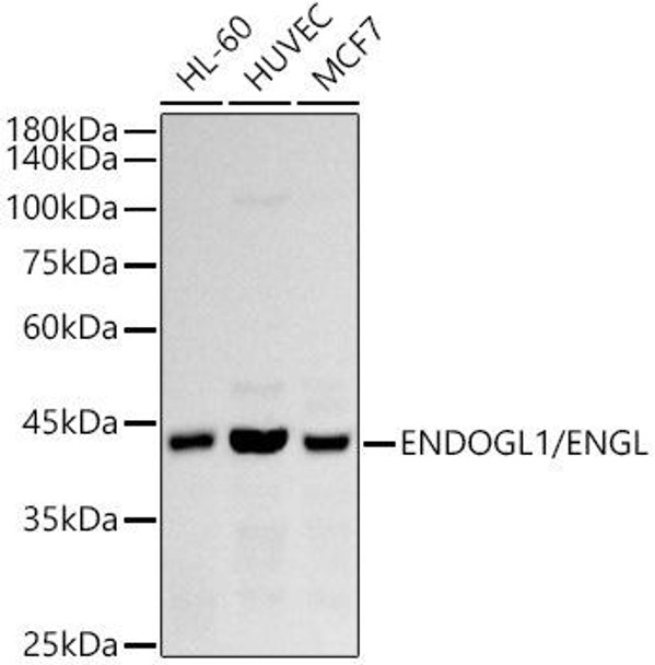 Western blot analysis of extracts of various cell lines, using ENDOGL1/ENGL antibody at 1:1000 dilution. Secondary antibody: HRP Goat Anti-Rabbit IgG (H+L) at 1:10000 dilution. Lysates/proteins: 25ug per lane. Blocking buffer: 3% nonfat dry milk in TBST. Detection: ECL Basic Kit. Exposure time: 90s.