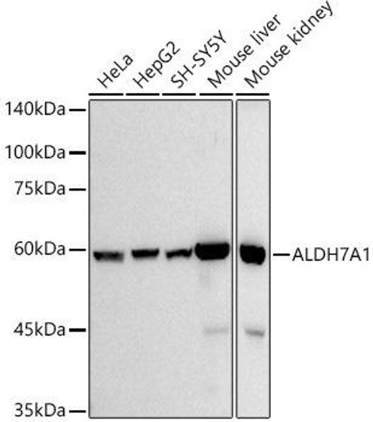 Western blot analysis of extracts of various cell lines, using ALDH7A1 antibody at 1:500 dilution. Secondary antibody: HRP Goat Anti-Rabbit IgG (H+L) at 1:10000 dilution. Lysates/proteins: 25ug per lane. Blocking buffer: 3% nonfat dry milk in TBST. Detection: ECL Basic Kit. Exposure time: 10s.