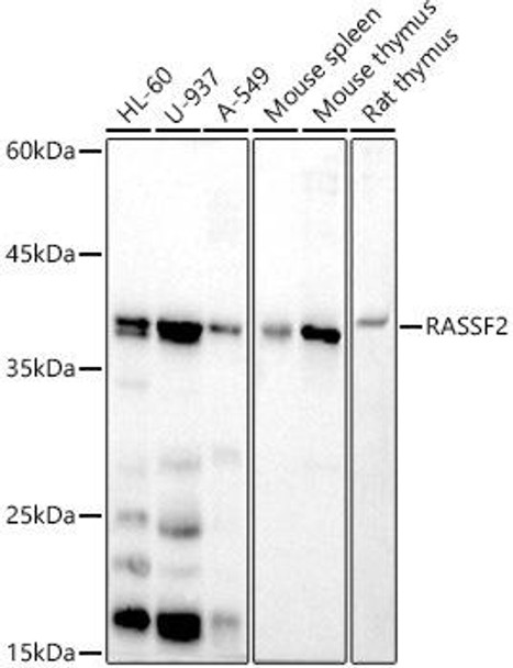 Western blot analysis of extracts of various cell lines, using RASSF2 antibody at 1:500 dilution. Secondary antibody: HRP Goat Anti-Rabbit IgG (H+L) at 1:10000 dilution. Lysates/proteins: 25ug per lane. Blocking buffer: 3% nonfat dry milk in TBST. Detection: ECL Basic Kit. Exposure time: 180s.