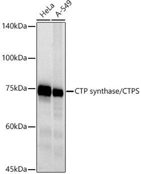Western blot analysis of extracts of various cell lines, using CTP synthase/CTPS antibody at 1:500 dilution. Secondary antibody: HRP Goat Anti-Rabbit IgG (H+L) at 1:10000 dilution. Lysates/proteins: 25ug per lane. Blocking buffer: 3% nonfat dry milk in TBST. Detection: ECL Basic Kit. Exposure time: 10s.