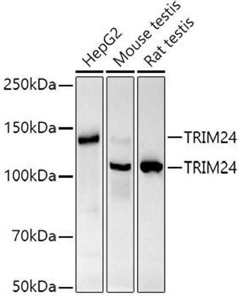 Western blot analysis of extracts of various cell lines, using TRIM24 antibody at 1:1000 dilution. Secondary antibody: HRP Goat Anti-Rabbit IgG (H+L) at 1:10000 dilution. Lysates/proteins: 25ug per lane. Blocking buffer: 3% nonfat dry milk in TBST. Detection: ECL Basic Kit. Exposure time: 60s.