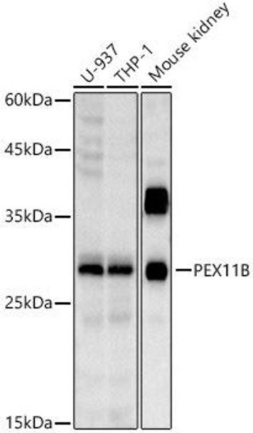 Western blot analysis of extracts of various cell lines, using PEX11B antibody at 1:1000 dilution. Secondary antibody: HRP Goat Anti-Rabbit IgG (H+L) at 1:10000 dilution. Lysates/proteins: 25ug per lane. Blocking buffer: 3% nonfat dry milk in TBST. Detection: ECL Basic Kit. Exposure time: 10s.