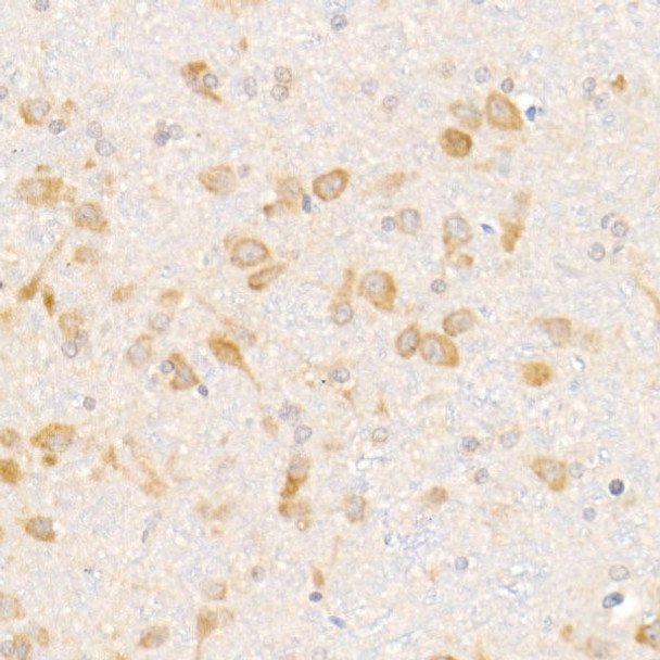 Immunohistochemistry of paraffin-embedded rat brain using eIF1A Rabbit mAb at dilution of 1:50 (40x lens). Perform high pressure antigen retrieval with 10 mM citrate buffer pH 6. 0 before commencing with IHC staining protocol.