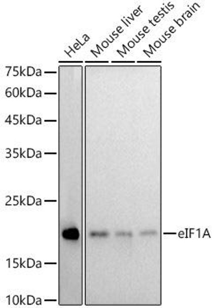Western blot analysis of extracts of various cell lines, using eIF1A antibody at 1:1000 dilution. Secondary antibody: HRP Goat Anti-Rabbit IgG (H+L) at 1:10000 dilution. Lysates/proteins: 25ug per lane. Blocking buffer: 3% nonfat dry milk in TBST. Detection: ECL Basic Kit. Exposure time: 180s.