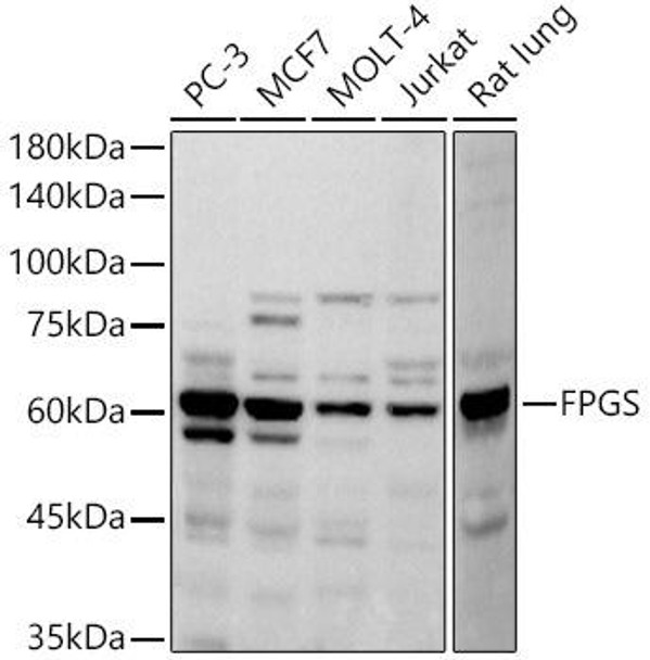 Western blot analysis of extracts of various cell lines, using FPGS antibody at 1:500 dilution. Secondary antibody: HRP Goat Anti-Rabbit IgG (H+L) at 1:10000 dilution. Lysates/proteins: 25ug per lane. Blocking buffer: 3% nonfat dry milk in TBST. Detection: ECL Basic Kit. Exposure time: 90s.