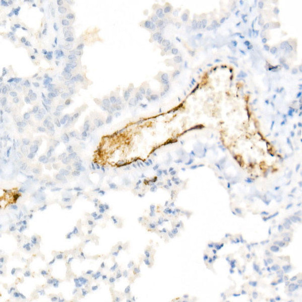 Immunohistochemistry of paraffin-embedded mouse lung using von Willebrand factor (VWF) antibody at dilution of 1:800 (40x lens). Perform high pressure antigen retrieval with 10 mM citrate buffer pH 6. 0 before commencing with IHC staining protocol.