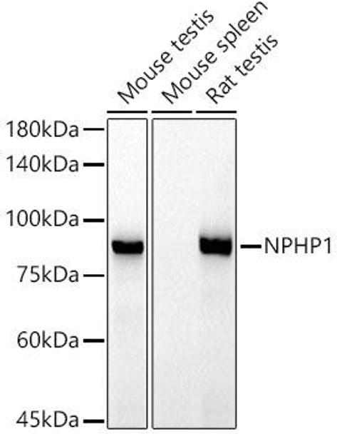 Western blot analysis of extracts of various cell lines, using NPHP1 antibody at 1:1000 dilution. Secondary antibody: HRP Goat Anti-Rabbit IgG (H+L) at 1:10000 dilution. Lysates/proteins: 25ug per lane. Blocking buffer: 3% nonfat dry milk in TBST. Detection: ECL Basic Kit. Exposure time: 90s.