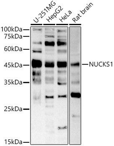 Western blot analysis of extracts of various cell lines, using NUCKS1 antibody at 1:1000 dilution. Secondary antibody: HRP Goat Anti-Rabbit IgG (H+L) at 1:10000 dilution. Lysates/proteins: 25ug per lane. Blocking buffer: 3% nonfat dry milk in TBST. Detection: ECL Basic Kit. Exposure time: 60s.