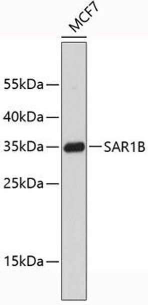 Western blot analysis of extracts of MCF-7 cells, using SAR1B antibody . Secondary antibody: HRP Goat Anti-Rabbit IgG (H+L) at 1:10000 dilution. Lysates/proteins: 25ug per lane. Blocking buffer: 3% nonfat dry milk in TBST.