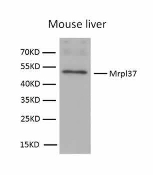 Western blot - Anti-MRPL37 Antibody (CAB4724)