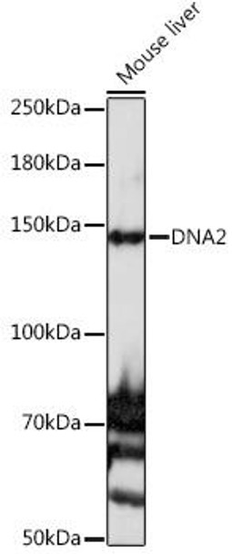 Western blot analysis of extracts of Mouse liver, using DNA2 antibody at 1:1000 dilution. Secondary antibody: HRP Goat Anti-Rabbit IgG (H+L) at 1:10000 dilution. Lysates/proteins: 25ug per lane. Blocking buffer: 3% nonfat dry milk in TBST. Detection: ECL Basic Kit. Exposure time: 120s.