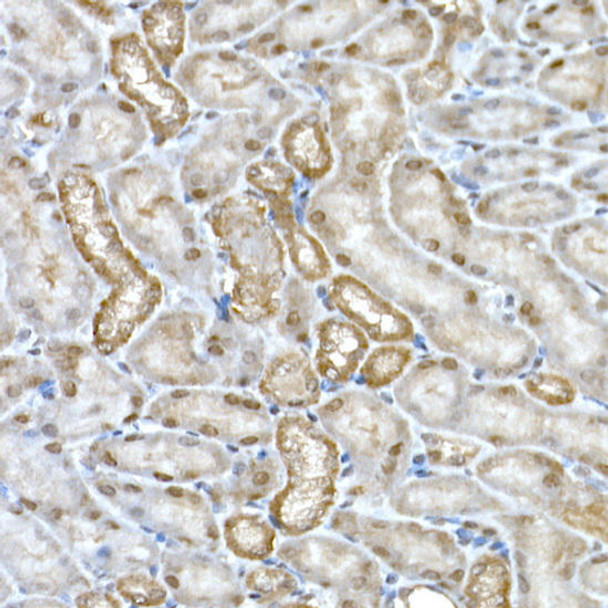 Immunohistochemistry of paraffin-embedded mouse kidney using DCAF7 Rabbit mAb at dilution of 1:200 (40x lens). Perform high pressure antigen retrieval with 10 mM citrate buffer pH 6. 0 before commencing with IHC staining protocol.