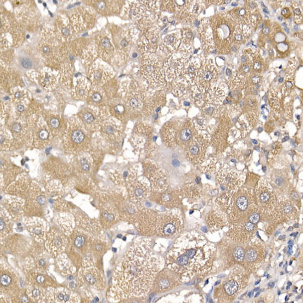 Immunohistochemistry of paraffin-embedded human liver using IL11RA Rabbit mAb at dilution of 1:150 (40x lens). Perform high pressure antigen retrieval with 10 mM citrate buffer pH 6. 0 before commencing with IHC staining protocol.