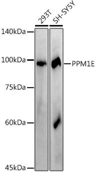 Western blot analysis of extracts of various cell lines, using at 1:1000 dilution. Secondary antibody: HRP Goat Anti-Rabbit IgG (H+L) at 1:10000 dilution. Lysates/proteins: 25ug per lane. Blocking buffer: 3% nonfat dry milk in TBST. Detection: ECL Basic Kit. Exposure time: 180s.