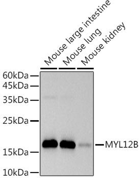 Western blot analysis of extracts of various cell lines, using at 1:500 dilution. Secondary antibody: HRP Goat Anti-Rabbit IgG (H+L) at 1:10000 dilution. Lysates/proteins: 25ug per lane. Blocking buffer: 3% nonfat dry milk in TBST. Detection: ECL Basic Kit. Exposure time: 3s.