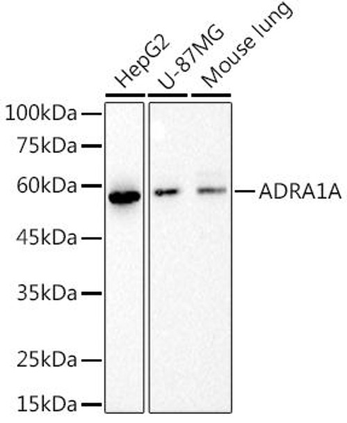 Western blot analysis of extracts of various cell lines, using at 1:1000 dilution. Secondary antibody: HRP Goat Anti-Rabbit IgG (H+L) at 1:10000 dilution. Lysates/proteins: 25ug per lane. Blocking buffer: 3% nonfat dry milk in TBST. Detection: ECL Basic Kit. Exposure time: 10s.