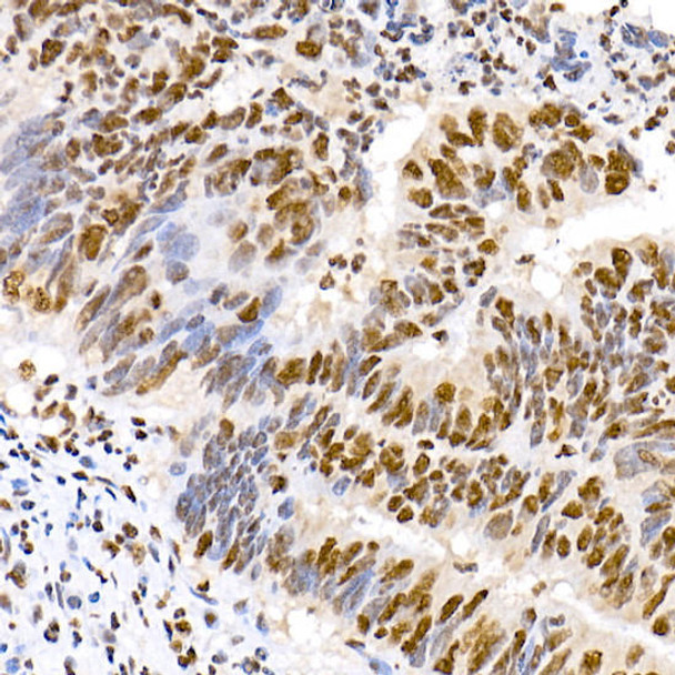 Immunohistochemistry - CMTM3 Rabbit pAb Immunohistochemistry of paraffin-embedded human liver using CMTM3 Rabbit pAb at dilution of 1:150 (40x lens). Perform high pressure antigen retrieval with 10 mM citrate buffer pH 6. 0 before commencing with IHC staining protocol.