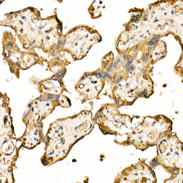 Immunohistochemistry - GSK-3α/β Rabbit pAb Immunohistochemistry of paraffin-embedded human placenta using GSK-3α/β Rabbit pAb at dilution of 1:25 (40x lens). Perform high pressure antigen retrieval with 10 mM citrate buffer pH 6. 0 before commencing with IHC staining protocol.