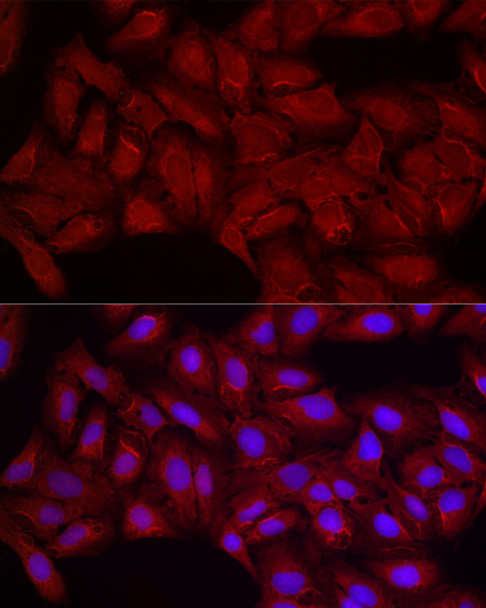 Immunofluorescence - SMG1 Rabbit pAb Immunofluorescence analysis of U2OS cells using SMG1 Rabbit pAb at dilution of 1:200 (40x lens). Blue: DAPI for nuclear staining.