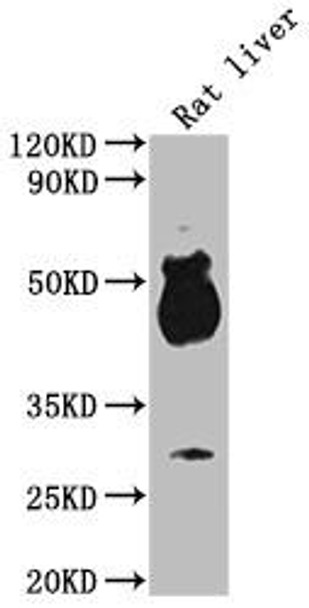 Western Blot<br />
Positive WB detected in: Rat liver tissue<br />
All lanes: Avpr1b antibody at 1:2000<br />
Secondary<br />
Goat polyclonal to rabbit IgG at 1/50000 dilution<br />
Predicted band size: 48 kDa<br />
Observed band size: 48 kDa<br />