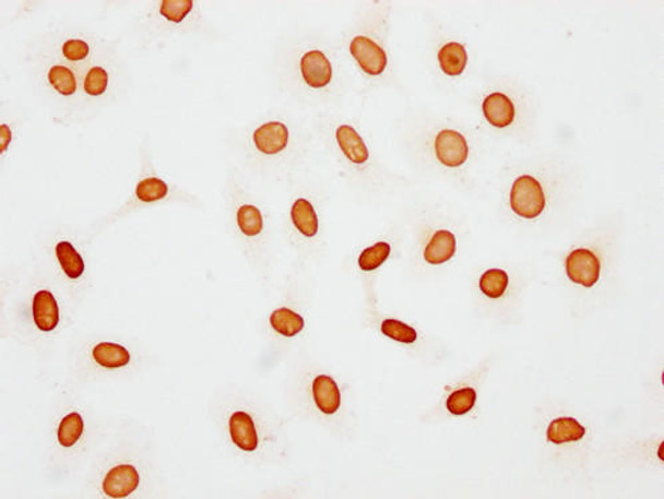 Immunocytochemistry analysis of PACO65063 diluted at 1:15 and staining in Hela cells(treated with 30mM sodium butyrate for 4h) performed on a Leica BondTM system. The cells were fixed in 4% formaldehyde, permeabilized using 0.2% Triton X-100 and blocked with 10% normal goat serum 30min at RT. Then primary antibody (1% BSA) was incubated at 4&deg;C overnight. The primary is detected by a biotinylated secondary antibody and visualized using an HRP conjugated SP system.