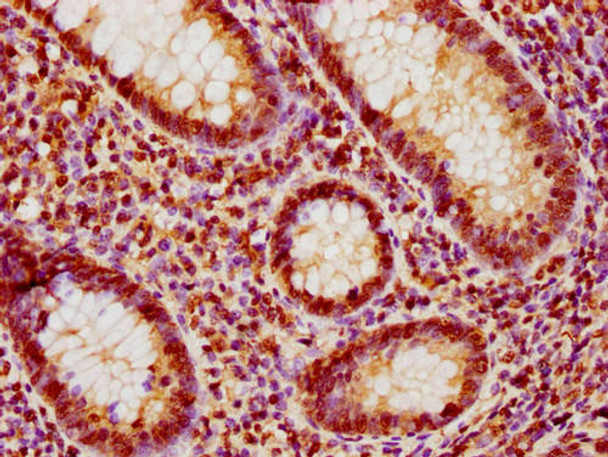 IHC image of PACO65066 diluted at 1:10 and staining in paraffin-embedded human appendix tissue performed on a Leica BondTM system. After dewaxing and hydration, antigen retrieval was mediated by high pressure in a citrate buffer (pH 6.0). Section was blocked with 10% normal goat serum 30min at RT. Then primary antibody (1% BSA) was incubated at 4&deg;C overnight. The primary is detected by a biotinylated secondary antibody and visualized using an HRP conjugated SP system.