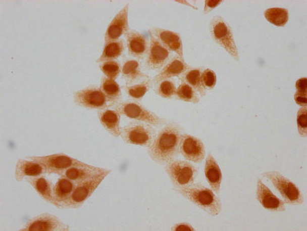 Immunocytochemistry analysis of PACO65126 diluted at 1:15 and staining in Hela cells(treated with 30mM sodium butyrate for 4h) performed on a Leica BondTM system. The cells were fixed in 4% formaldehyde, permeabilized using 0.2% Triton X-100 and blocked with 10% normal goat serum 30min at RT. Then primary antibody (1% BSA) was incubated at 4&deg;C overnight. The primary is detected by a biotinylated secondary antibody and visualized using an HRP conjugated SP system.