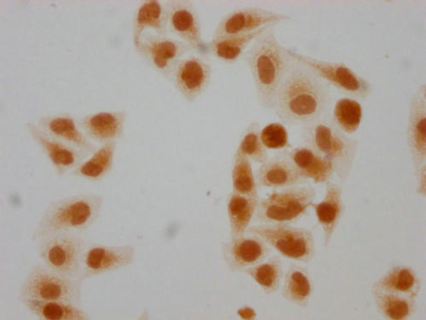 Immunocytochemistry analysis of PACO65129 diluted at 1:10 and staining in Hela cells(treated with 30mM sodium butyrate for 4h) performed on a Leica BondTM system. The cells were fixed in 4% formaldehyde, permeabilized using 0.2% Triton X-100 and blocked with 10% normal goat serum 30min at RT. Then primary antibody (1% BSA) was incubated at 4&deg;C overnight. The primary is detected by a biotinylated secondary antibody and visualized using an HRP conjugated SP system.