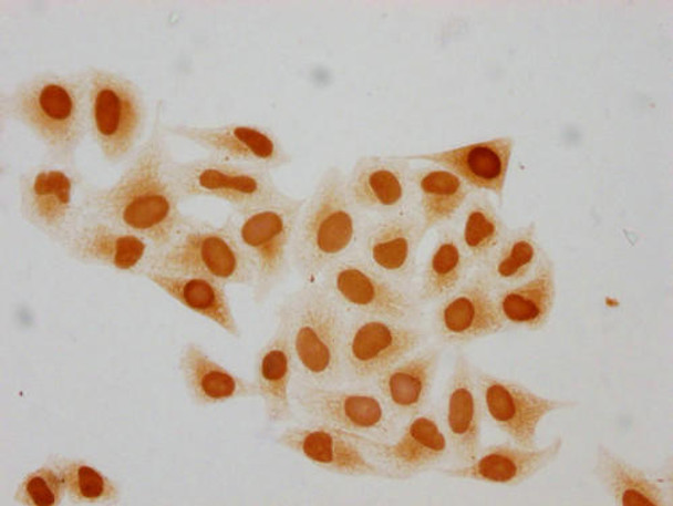 Immunocytochemistry analysis of PACO65131 diluted at 1:20 and staining in Hela cells performed on a Leica BondTM system. The cells were fixed in 4% formaldehyde, permeabilized using 0.2% Triton X-100 and blocked with 10% normal goat serum 30min at RT. Then primary antibody (1% BSA) was incubated at 4&deg;C overnight. The primary is detected by a biotinylated secondary antibody and visualized using an HRP conjugated SP system.