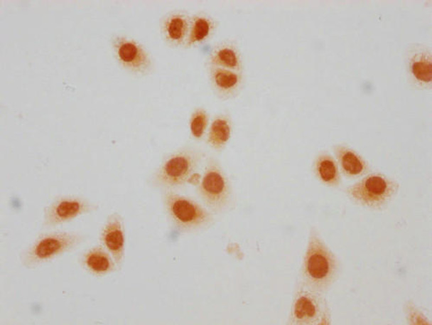 Immunocytochemistry analysis of PACO65141 diluted at 1:50 and staining in Hela cells(treated with 30mM sodium crotonylate for 4h) performed on a Leica BondTM system. The cells were fixed in 4% formaldehyde, permeabilized using 0.2% Triton X-100 and blocked with 10% normal goat serum 30min at RT. Then primary antibody (1% BSA) was incubated at 4&deg;C overnight. The primary is detected by a biotinylated secondary antibody and visualized using an HRP conjugated SP system.