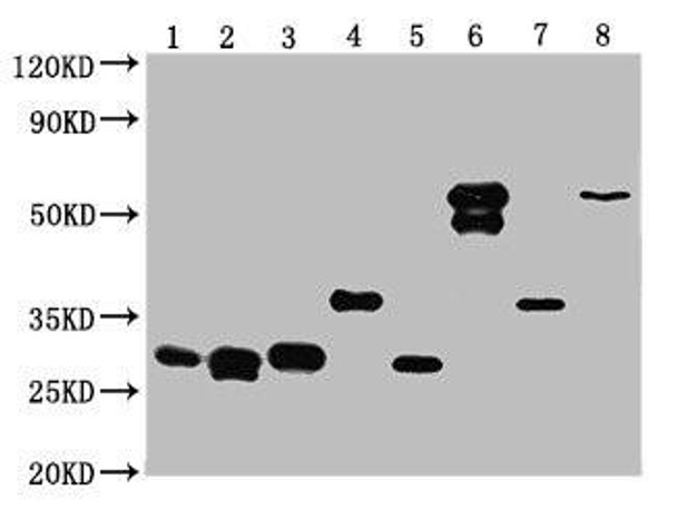 Western Blot<br /> Positive WB detected in: 25ng Recombinant protein with GST tag from E.coli<br />  All lanes: GST antibody at 1:10000<br /> Secondary<br /> Goat polyclonal to mouse IgG at 1/50000 dilution<br /> Predicted band size: 32.6, 30.1, 29.5, 37.4, 30.4, 60.5, 38.1, 61.6 KDa<br /> Observed band size: 31, 30, 31, 37, 30, 60, 37, 61 KDa<br /> Exposure time: 5min