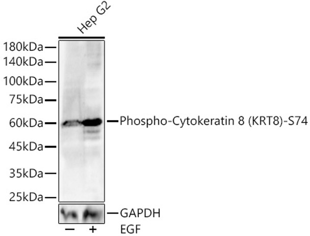 Western blot analysis of lysates from Hep G2, using Phospho-Cytokeratin 8 (KRT8)-S74 Rabbit pAb (CABP1299) at 1:1000 dilution. Hep G2 cells were treated by EGF (100 ng/ml) at 37℃ for 30 minutes after serum-starvation overnight. Secondary antibody: HRP Goat Anti-Rabbit IgG (H+L) at 1:10000 dilution. Lysates/proteins: 25ug per lane. Blocking buffer: 3% nonfat dry milk in TBST.