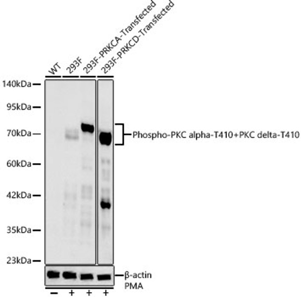 Western blot analysis of various lysates, using Phospho-PKC alpha-T410+PKC delta-T410 Rabbit mAb (CABP1506) at 1:2000 dilution. 293F、293F-PRKCA-Transfected and 293F-PRKCD-Transfected cells were treated by PMA (200 nM) at 37℃ for 30 minutes. Secondary antibody: HRP Goat Anti-Rabbit IgG (H+L) at 1:10000 dilution. Lysates/proteins: 25μg per lane. Blocking buffer: 3% nonfat dry milk in TBST.
