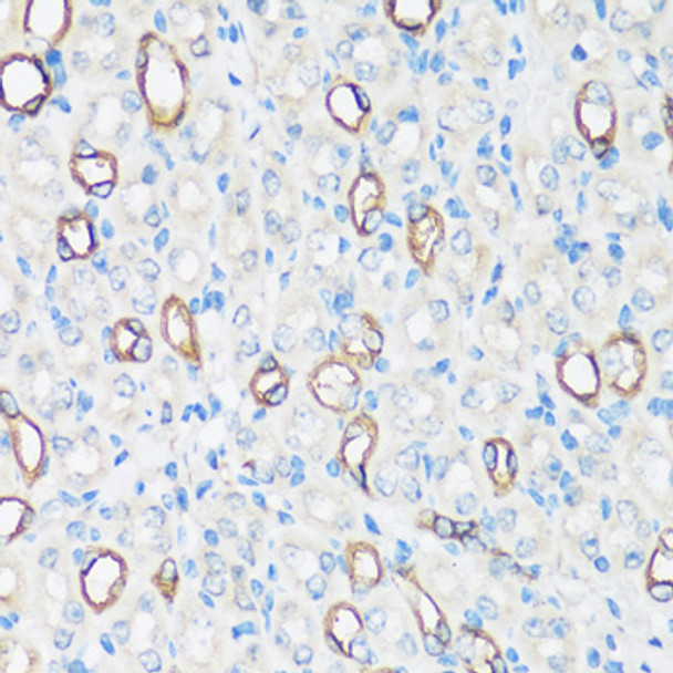 Immunohistochemistry analysis of paraffin-embedded mouse kidney using AQP2 antibody (CAB12998) at dilution of 1:100 (40x lens). Perform microwave antigen retrieval with 10 mM PBS buffer pH 7. 2 before commencing with IHC staining protocol.