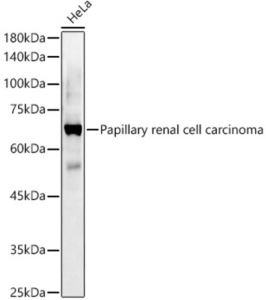 Western blot analysis of HeLa, using Papillary renal cell carcinoma antibody (CAB18781) at 1:1000 dilution. Secondary antibody: HRP Goat Anti-Rabbit IgG (H+L) at 1:10000 dilution. Lysates/proteins: 25μg per lane. Blocking buffer: 3% nonfat dry milk in TBST.