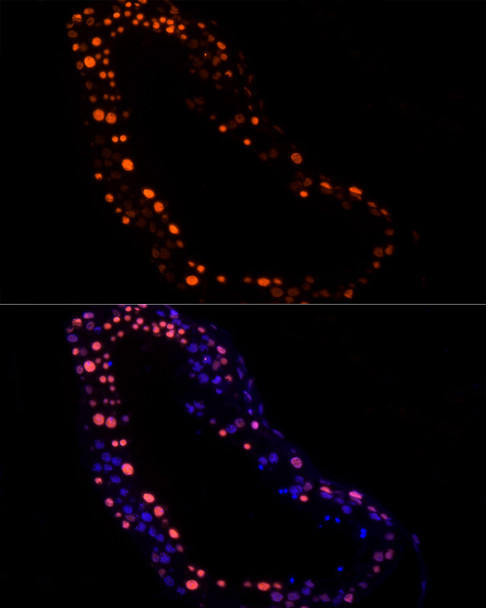 Immunofluorescence analysis of human testis using RBMXL2 Rabbit mAb (CAB21075) at dilution of 1:100 (40x lens). Blue: DAPI for nuclear staining. Perform high pressure antigen retrieval with 10 mM citrate buffer pH 6. 0 before commencing with IF staining protocol.