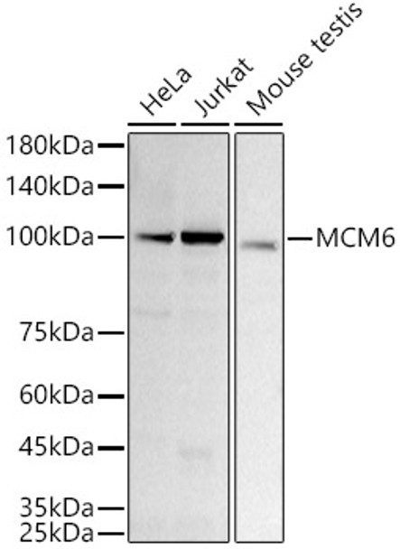 Western blot analysis of extracts of various cell lines, using MCM6 antibody (CAB21112) at1:1000 dilution. Secondary antibody: HRP Goat Anti-Rabbit IgG (H+L) at 1:10000 dilution. Lysates/proteins: 25μg per lane. Blocking buffer: 3% nonfat dry milk in TBST.