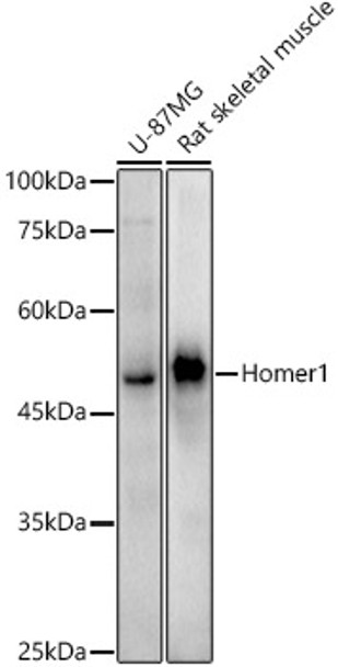 Western blot analysis of extracts of various cell lines, using Homer1 antibody (CAB21136) at1:1000 dilution. Secondary antibody: HRP Goat Anti-Rabbit IgG (H+L) at 1:10000 dilution. Lysates/proteins: 25μg per lane. Blocking buffer: 3% nonfat dry milk in TBST.